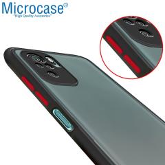 Microcase Xiaomi Redmi Note 10S London Serisi Kılıf - Buzlu Siyah