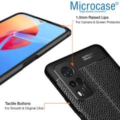 Microcase Vivo Y31 2021 Leather Tpu Silikon Kılıf - Siyah