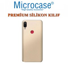 Microcase Xiaomi Mi Play Premium Matte Silikon Kılıf + Tempered Glass Cam Koruma (SEÇ)