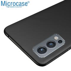 Microcase OnePlus Nord 2 5G Matte Serisi Silikon Kılıf - Siyah