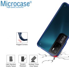 Microcase Xiaomi Poco M3 Pro Luna Serisi Köşe Korumalı Sert Rubber Kılıf - Mavi