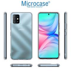 Microcase Infinix Note 10 0.2 mm İnce Silikon Kılıf - Şeffaf