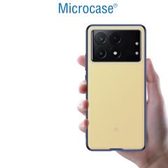 Microcase Poco X6 Pro /Xiaomi Redmi K70E  Luna Serisi Köşe Korumalı Sert Rubber Kılıf - AL3422