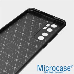 Microcase Xiaomi Mi Note 10 Lite Brushed Carbon Fiber Silikon Kılıf - Siyah