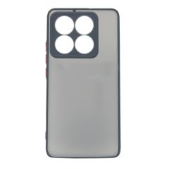 Microcase Xiaomi 14T Pro London Serisi Darbeye Dayanıklı Kılıf - Siyah AL3415