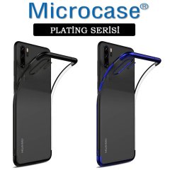 Microcase Huawei P30 Pro Plating Silikon Kılıf (Renk Seçenekli)