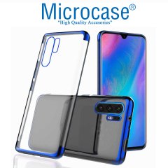 Microcase Huawei P30 Pro Plating Silikon Kılıf (Renk Seçenekli)