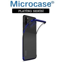 Microcase Huawei P30 Pro Plating Silikon Kılıf (Renk Seçenekli)