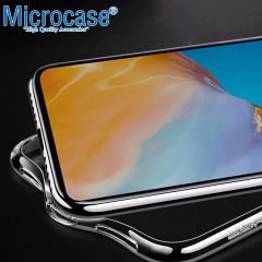 Microcase Realme 10 4G Slim Serisi Soft TPU Silikon Kılıf - Şeffaf AL3324