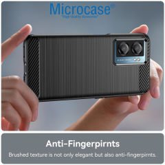 Microcase OnePlus Nord N20 SE Brushed Carbon Fiber Silikon Kılıf - Siyah