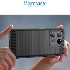 Microcase OnePlus Ace Racing Brushed Carbon Fiber Silikon Kılıf - Siyah