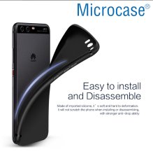 Huawei P10 Lite Elektrocase Serisi Silikon Kılıf + Tempered Cam