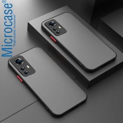 Microcase Xiaomi 12S London Serisi Darbeye Dayanıklı Kılıf - Buzlu Siyah