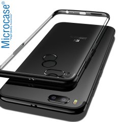 Xiaomi Mi 5X - Mi A1 Plating Series Soft Silikon Kılıf + CAM