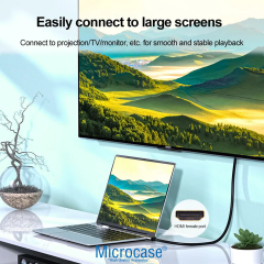 Microcase Ultra HD 8K Alüminyum Başlıklı HDMI To HDMI Kablo 1.5 Metre - AL5083