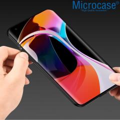 Microcase OnePlus 9 Fabrik Serisi Kumaş Desen Kılıf - Gri