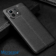 Microcase Xiaomi Mi 11 Lite Leather Tpu Silikon Kılıf - Siyah