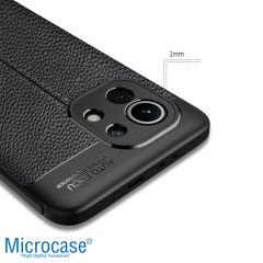 Microcase Xiaomi Mi 11 Lite Leather Tpu Silikon Kılıf - Siyah