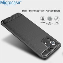 Microcase Xiaomi Mi 11 Lite Brushed Carbon Fiber Silikon Kılıf - Siyah