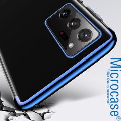 Microcase Samsung Galaxy Note 20 Plating Series Soft Silikon Kılıf - Mavi