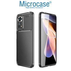 Microcase Xiaomi Redmi Note 11 Global Maxy Serisi Carbon Fiber Silikon TPU Kılıf - Siyah