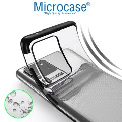 Microcase Samsung Galaxy S20 Ultra Plating Series Soft Silikon Kılıf - Siyah