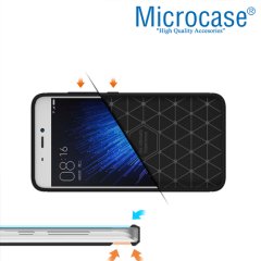 Microcase Xiaomi Mi 5s Brushed Carbon Silikon Kılıf+Tam Kaplar
