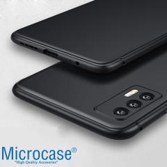 Microcase Realme GT 5G Elektrocase Serisi Silikon Kılıf - Siyah
