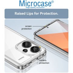 Microcase Xiaomi Redmi Note 13 Pro Plus Global Shield Serisi Darbeye Dayanıklı Yarı Esnek Plastik TPU Kılıf - AL8100