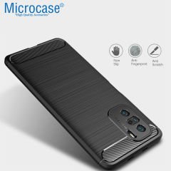 Microcase Xiaomi Mi 11i Brushed Carbon Fiber Silikon Kılıf - Siyah