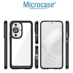 Microcase Huawei Nova 12S / Nova 11 Shield Serisi Darbeye Dayanıklı Yarı Esnek Plastik Tpu Kılıf - AL8100