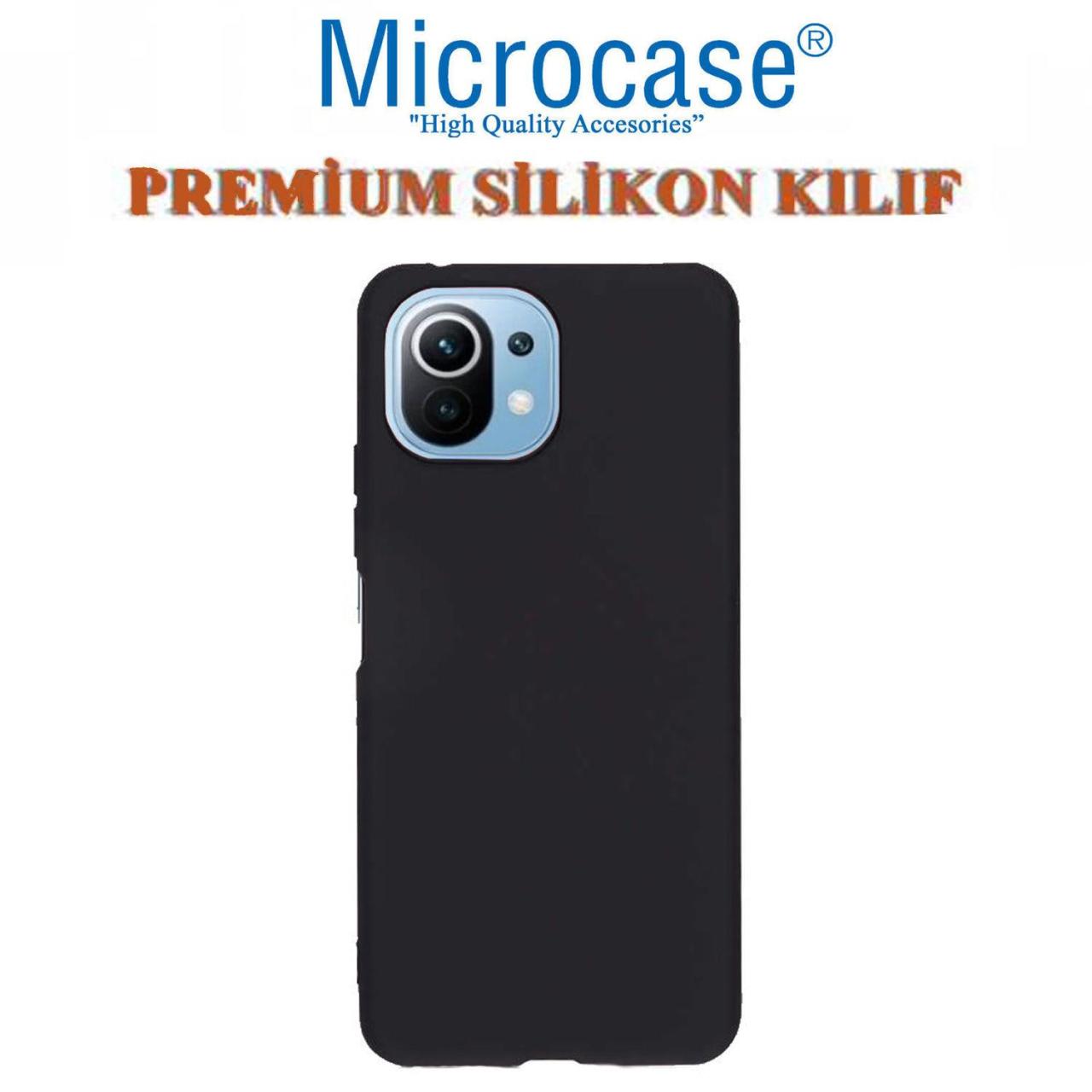 Microcase Xiaomi Mi 11 Youth Premium Matte Silikon Kılıf - Siyah