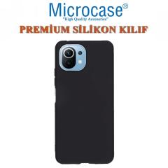 Microcase Xiaomi Mi 11 Youth Premium Matte Silikon Kılıf - Siyah