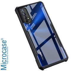 Microcase Realme 7 Airbag Serisi Darbeye Dayanıklı Tpu Kılıf