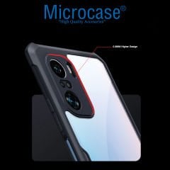 Microcase Xiaomi Redmi Note 10 Airbag Serisi Darbeye Dayanıklı Tpu Kılıf