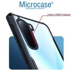 Microcase OnePlus Nord Airbag Serisi Darbeye Dayanıklı Tpu Kılıf