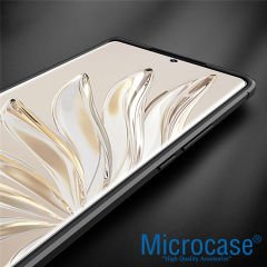 Microcase Honor 70 Leather Serisi Deri Efekt Silikon Kılıf - Siyah AL3337