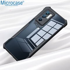 Microcase Xiaomi Redmi Note 11 SE Airbag Serisi Darbeye Dayanıklı Tpu Kılıf