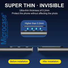 Microcase Huawei Nova 13 Pro Uyumlu Kamera Lens Koruma Halkası - Kapalı Tasarım -Siyah AL3401