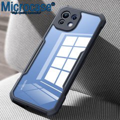 Microcase Xiaomi Mi 11 Airbag Serisi Darbeye Dayanıklı Tpu Kılıf