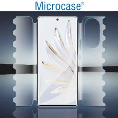 Microcase Honor 90  Ön Arka Yan Koruma Full Body Film - FL360