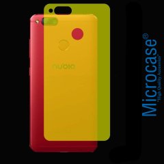 Microcase ZTE Nubia Z17 Mini Full Arka Kaplama TPU Koruma Filmi