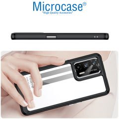 Microcase Realme GT 5G Shield Serisi Darbeye Dayanıklı Köşe Korumalı Yarı Esnek Plastik TPU Kılıf - Siyah