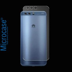 Microcase Huawei P10 Full Arka Kaplama TPU Soft Koruma Filmi