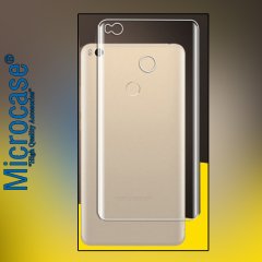 Microcase Xiaomi Mi Max 2 Full Arka Kaplama TPU Soft Koruma Filmi
