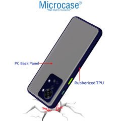 Microcase OnePlus Nord 2T London Serisi Darbeye Dayanıklı Kılıf - AL3415