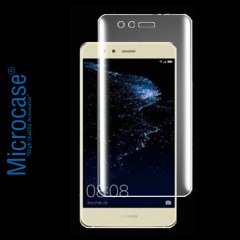 Microcase Huawei P10 Lite Full Ön Kaplama TPU Soft Koruma Filmi