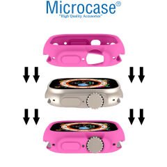 Microcase Apple Watch Ultra 49mm Önü Açık Mat Silikon Kılıf - AL3172