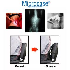 Microcase Ortopedik Fileli Koltuk ve Oto Bel Desteği Sırtlık + Oto Araç Koltuk Minderi AL4633