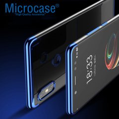 omi Redmi S2 Plating Series Soft Silikon Kılıf + CAM